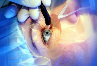 Ophthalmology Ophthalmology