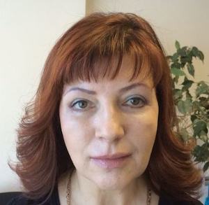 cherez 1 mesyatc posle blefaroplastiki