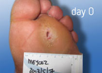 рана в день обращения в центр реДермис рана в день обращения в центр реДермис