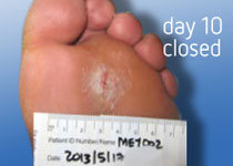 на 10 день после обращения в центр реДермисс на 10 день после обращения в центр реДермисс